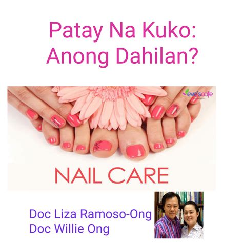 Patay Na Kuko: Anong .